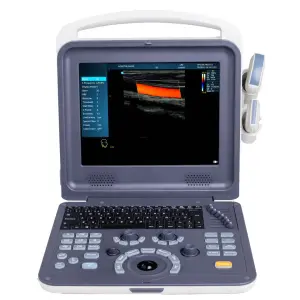 Smart Portable Human Full Digital Color Doppler Laptop Ultrasound Medical Imaging Machine