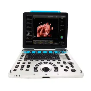Portable 4D Color Doppler Ultrasound Machine Medical Device with Electric Power Source Made of Durable Metal and Plastic