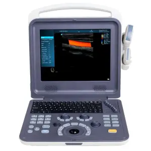High Resolution Portable Color Doppler Ultrasonic Diagnostic System Medical Ultrasound Instruments