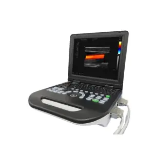 Color Portable Ultrasound Scanner for Medical Diagnostic Imaging Center Using Medical for Hospital Clinic