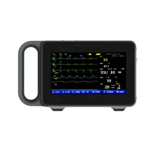 Portable Multiparameter Patient Monitor Vital Sign ECG Waveform Electric Power Source Made Plastic Examination Therapy Equipment