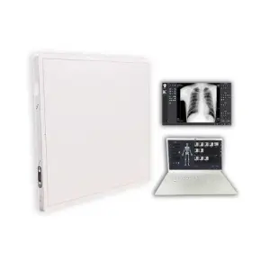 17*17 Digital Flat Panel Radiology X-Ray Machines Medical Equipment for Pet Diagnosis with Reusable Accessories