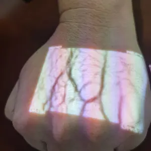 Medical Portable Infrared Vein Detector Handheld Class III Immunoassay System for Blood Analysis