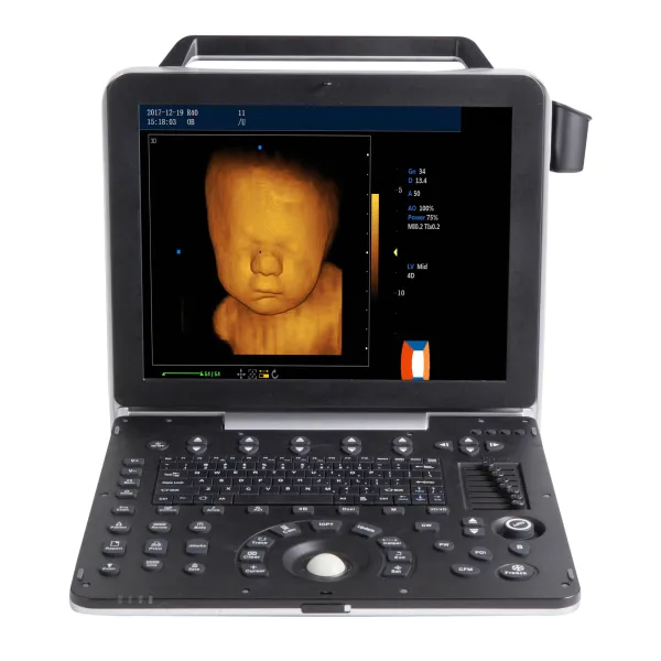 4D and 5D Portable Ultrasound Machine