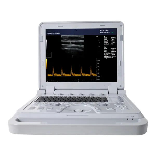 CONTEC CMS600P2PLUS hospital ultrasound portable ultrasound equipment