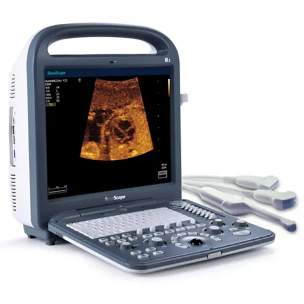 Sonoscape S2 Medical Ultrasound Instruments Portable Color Ultrasound Doppler 3d 4d for hospital for sale