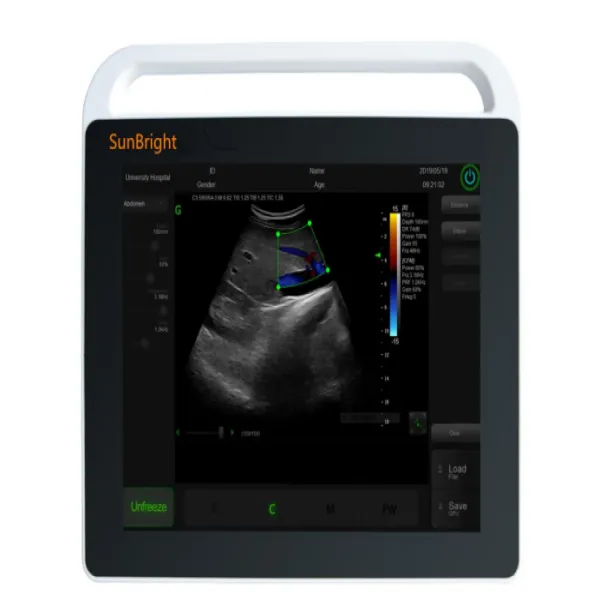 SUN-800S Human Ultrasound Scanner with Touch Screen