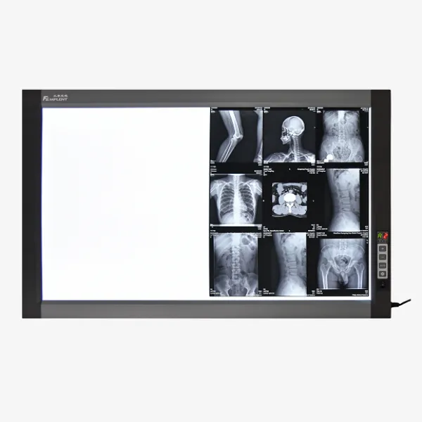 Professional Economical Hospital Led Xray X-ray Film Viewer Negatoscope Xray HFZG-D