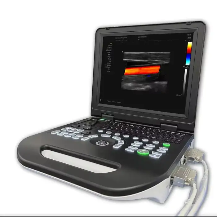 Chenwei Portable Animal Medical Equipment Ultrasound Machine ultrasound scanner
