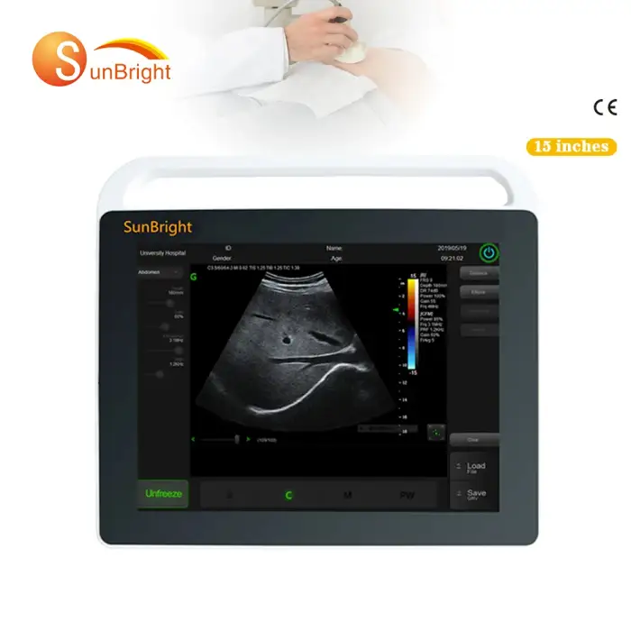 Medical Ultrasound Machine 15 inches touch screen USG portable ultrasound scanner machine