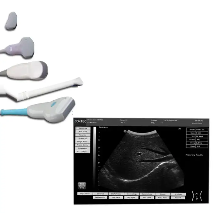 Portable  ultrasonic diagnostic doppler ultrasound equipment