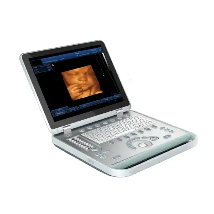 SY-A039  Guangzhou USG 4D ultrasound machine price of Medical Equipment