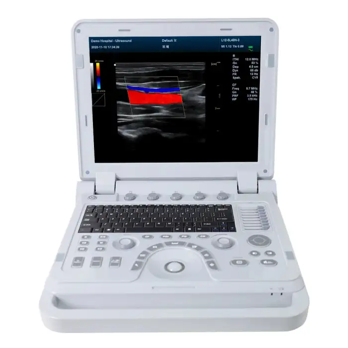 CONTEC portable ultrasound machine