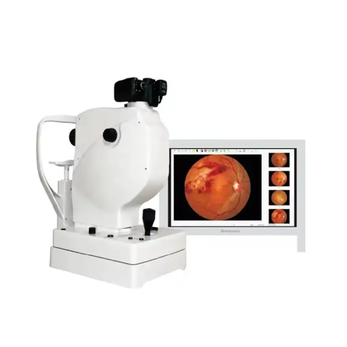 Non-Mydriatic Eye Fundus Camera for Retinal Examination