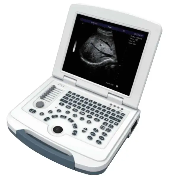 Color Tablet Ultrasound Portable Full Digital B/W Ultrasound Scanner For Human