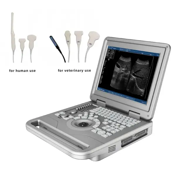 Advanced Portable Full Digital B/W Ultrasound Scanner Diagnostic Medical Equipment Machine