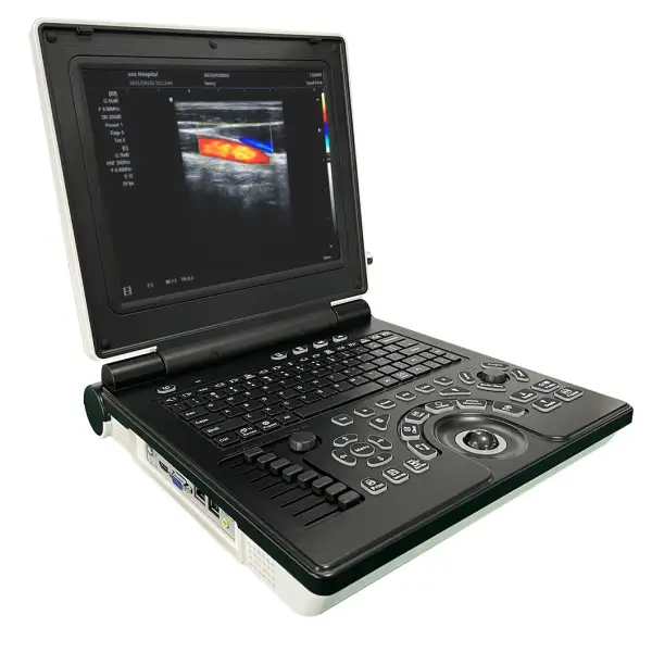 Portable Color Doppler Ultrasonic Laptop Ultrasound Scanner Medical Diagnostic Device