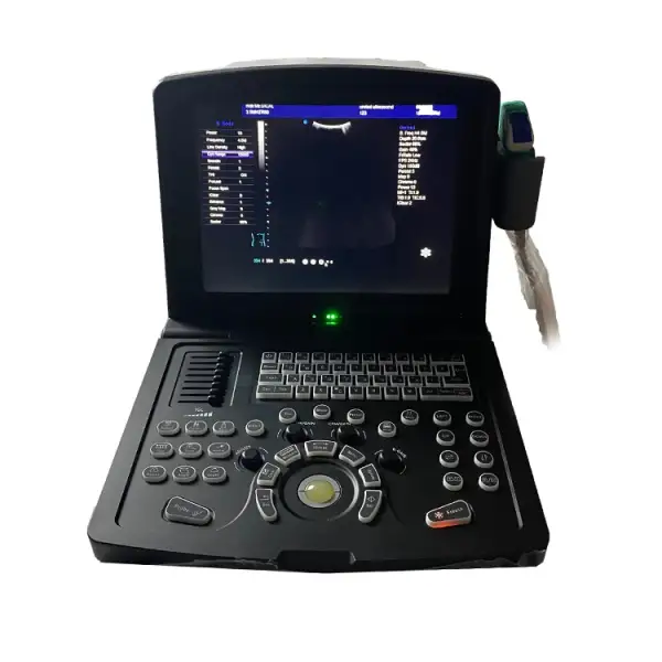 Portable Ultrasound Advanced Diagnostic System Innovative Portable Ultrasound Device Machine