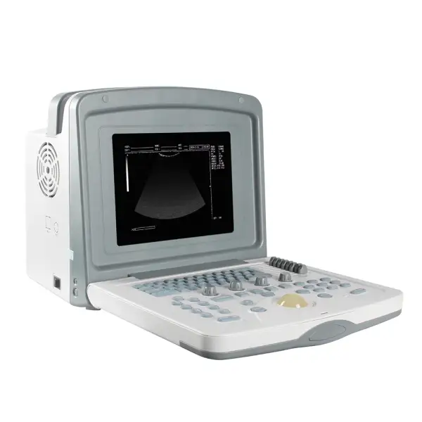 Portable Ultrasound Scanner Medical Equipment Hospital Ultrasound Diagnostic Machine