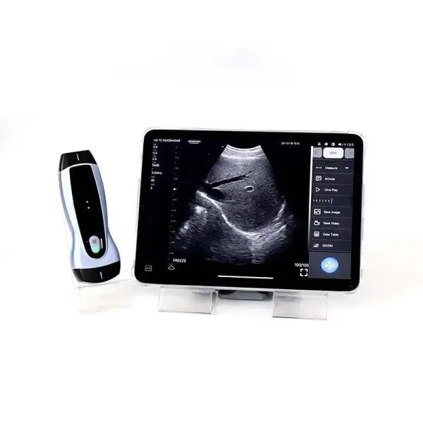 Handheld WiFi Portable Color Digital Scanner High-Quality Wireless Ultrasound Probe Machine