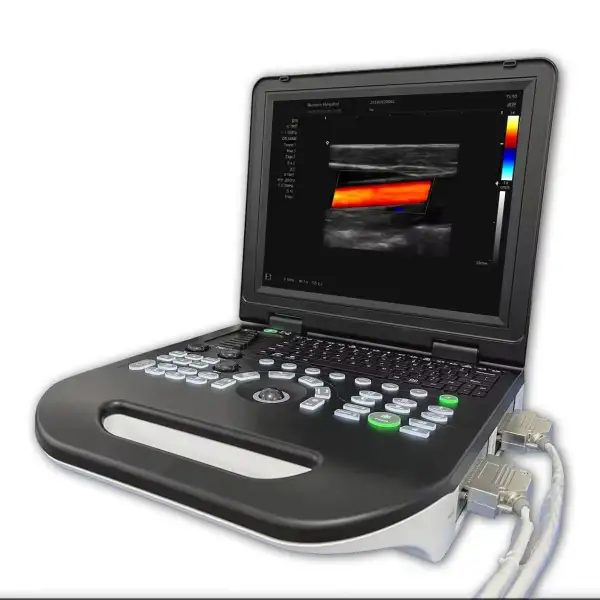 Portable 3D 4D Color Doppler Ultrasound Machine Vet Ultrasound Scanner Device