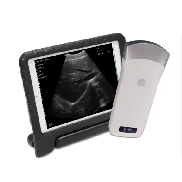 Portable Smartphone Convex Phased Array Ultrasound Scanner Imaging Device Solution